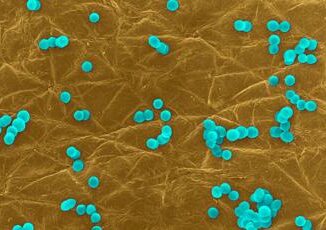 Infezioni da superbatteri costano circa 1 miliardo allanno roadmap con 10 priorita