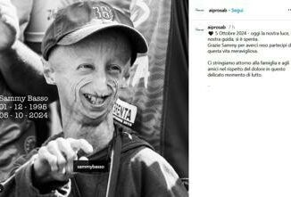 Morto Sammy Basso il 28enne italiano malato di Progeria